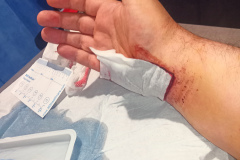 IMG_20230519_071314Z_QA_wound_dressing