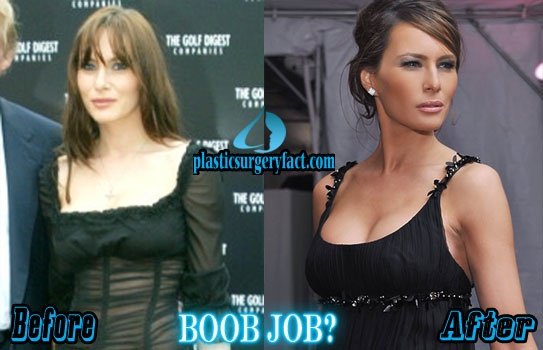 20260501-melania-trump-plastic