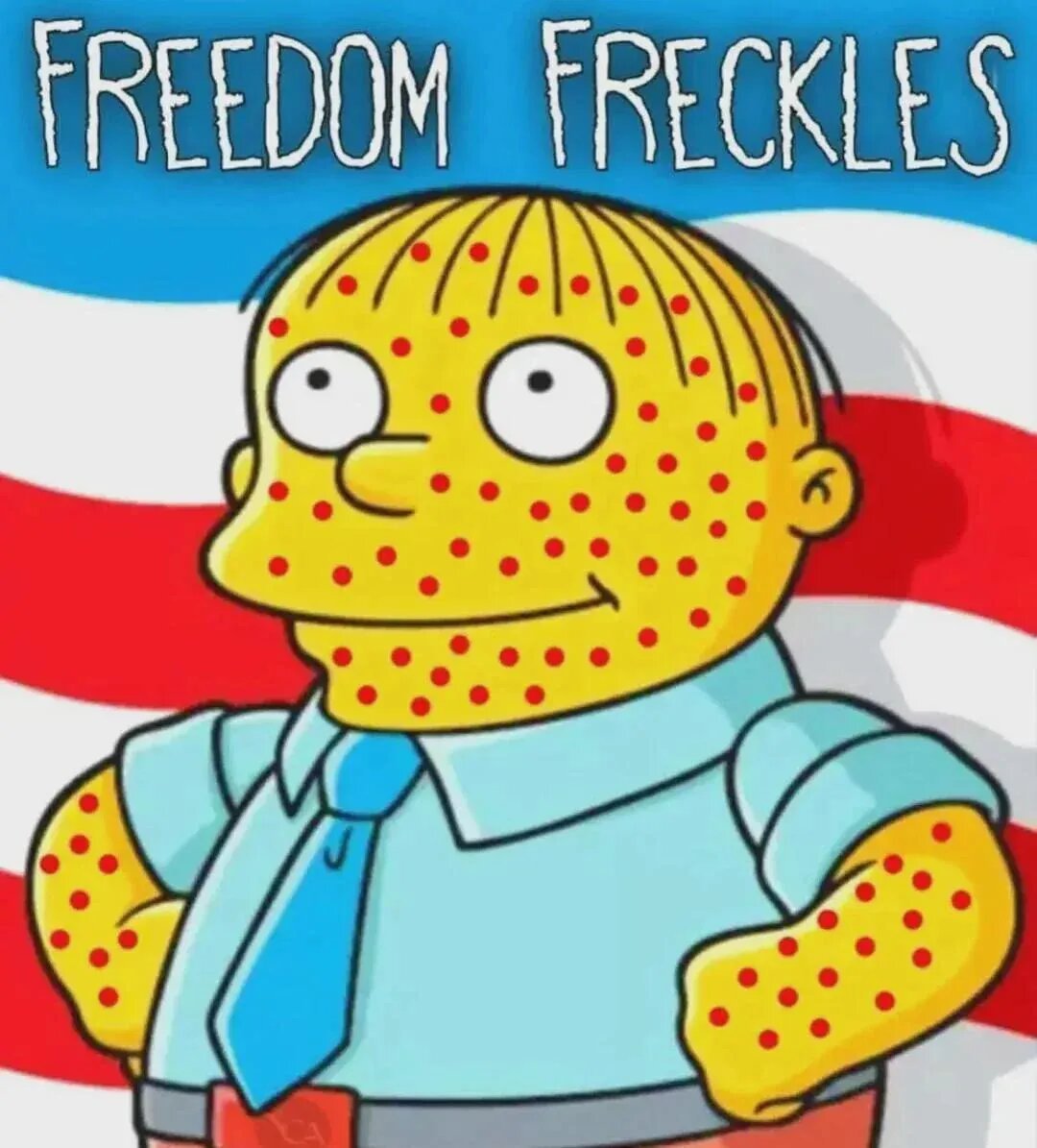 20260831-measels-freedom-freckles