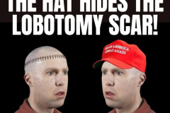 20230608-maga-lobotomy-scar