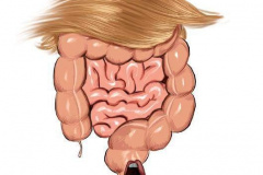 20230817-trump-bowels