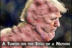 20230817-trump-tumour