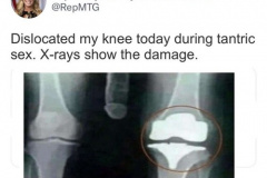 20231208-mtg-dislocated-knee