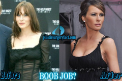 20260501-melania-trump-plastic