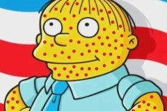20260831-measels-freedom-freckles